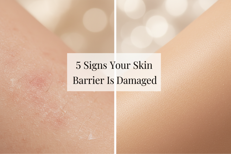 5 Signs Your Skin Barrier Is Damaged
