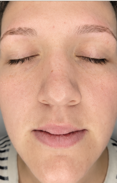 After — Dark spots & uneven tone