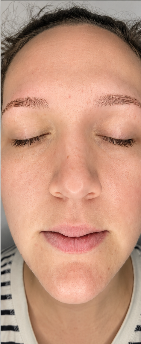 After — Redness & sensitivity
